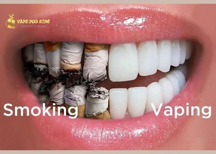 Hút vape có vàng răng không